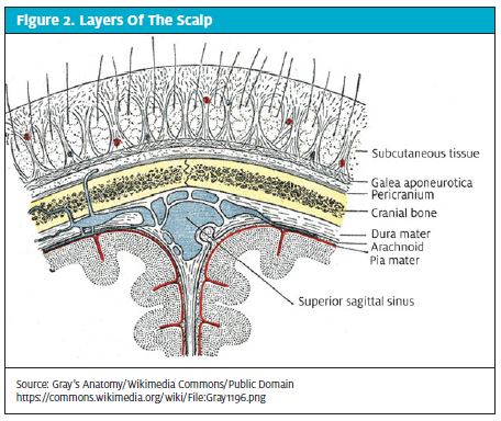 How to Identify and Repair a Laceration Like a Professional